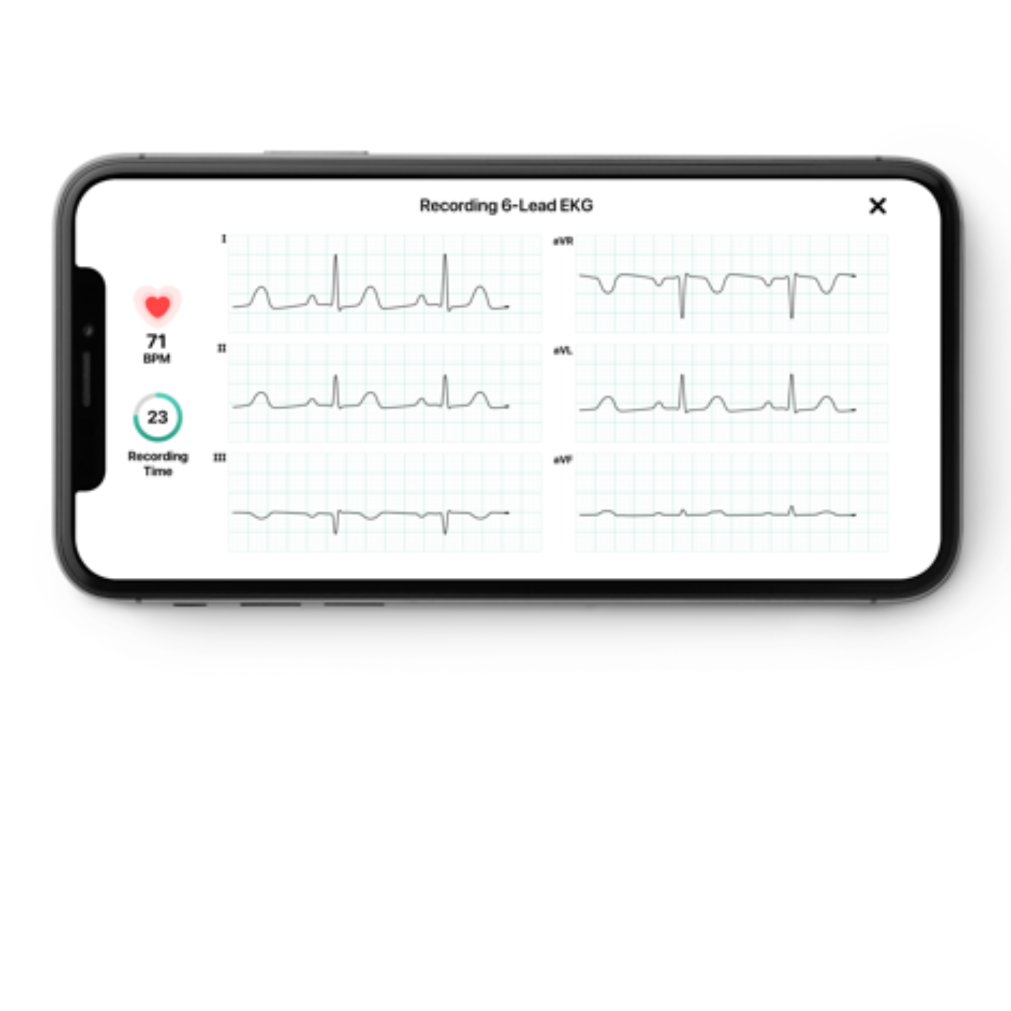 Electrocardiographe ECG KardiaMobile - Omron