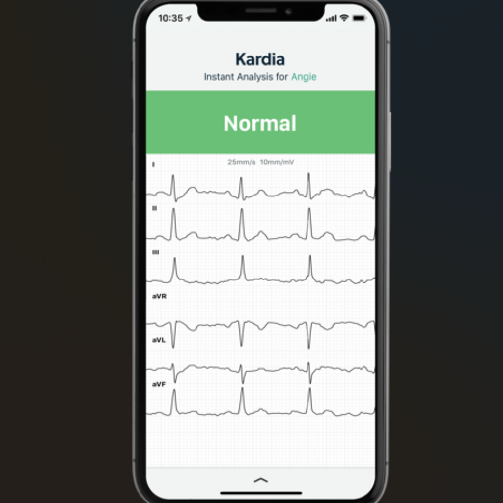 Electrocardiographe ECG KardiaMobile - Omron