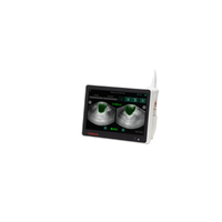 Bladder scanner VitaScan