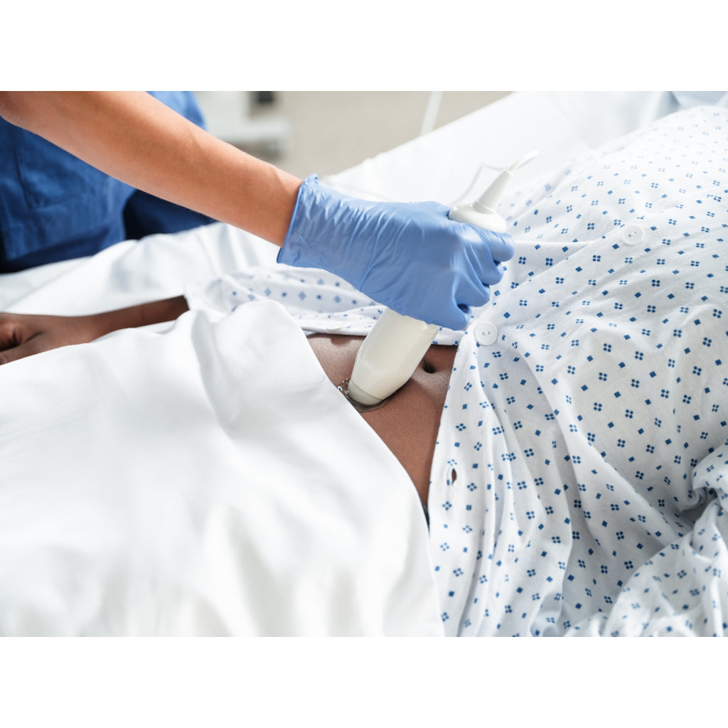 Bladder scanner VitaScan