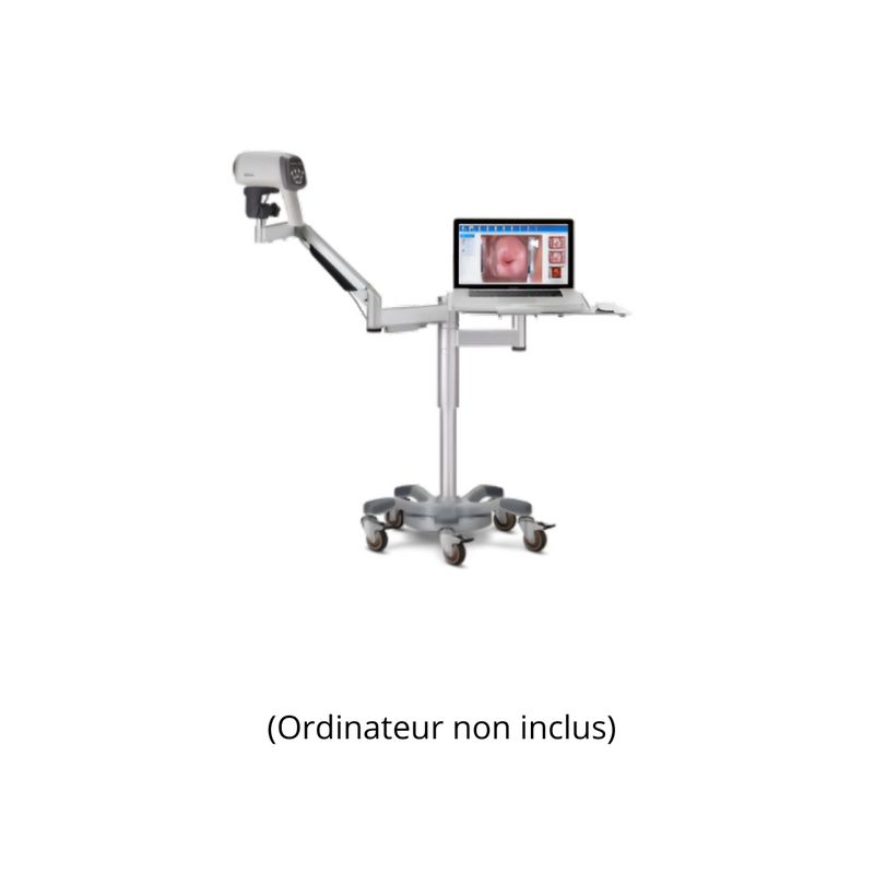 Vidéo-colposcope C6A- EDAN