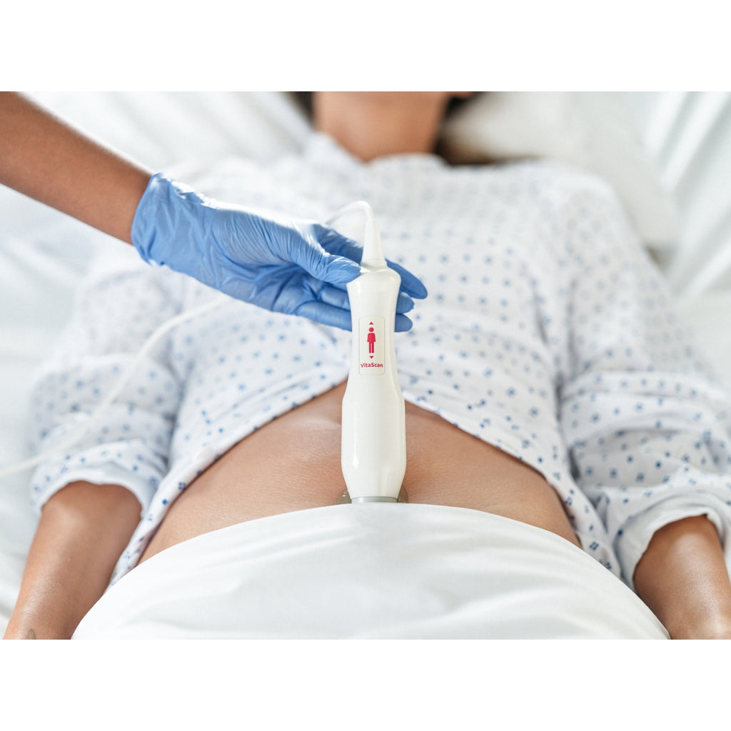 Bladder scanner VitaScan