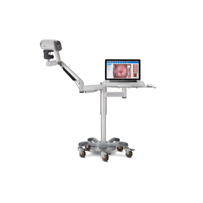 Vidéo-colposcope C6A- EDAN