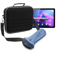 Echographe couleur portable Edan Nano convexe