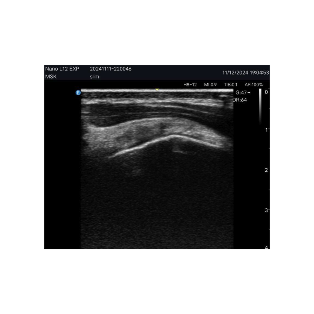 Echographe couleur portable Edan Nano linéaire