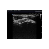 Echographe couleur portable Edan Nano linéaire