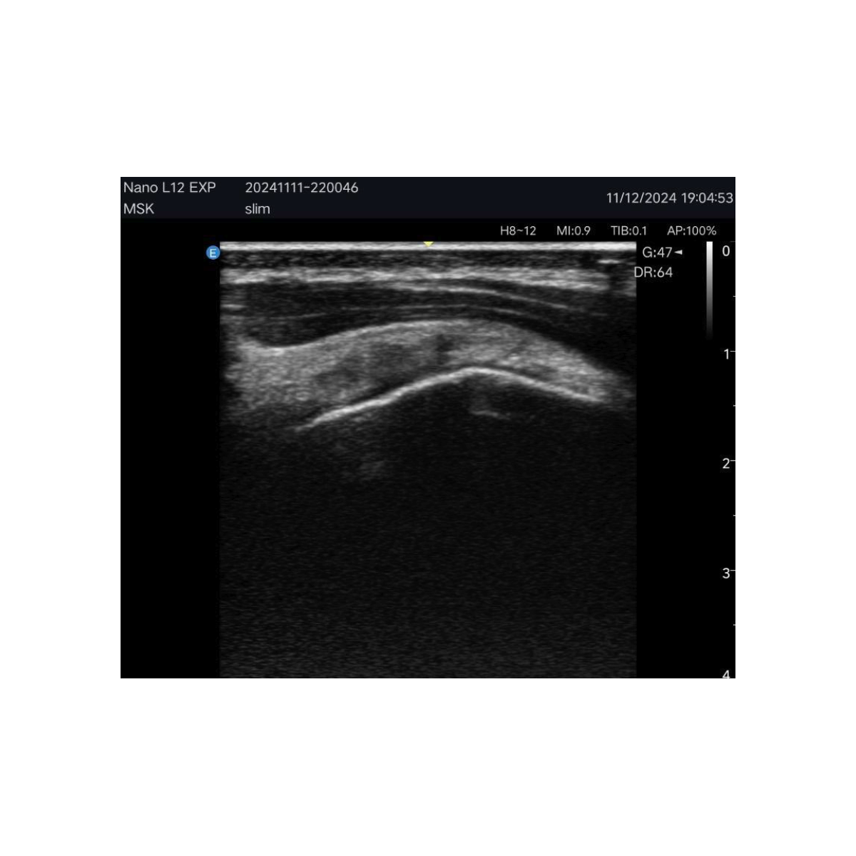 Echographe couleur portable Edan Nano linéaire