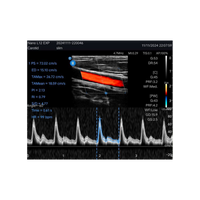 Echographe couleur portable Edan Nano linéaire