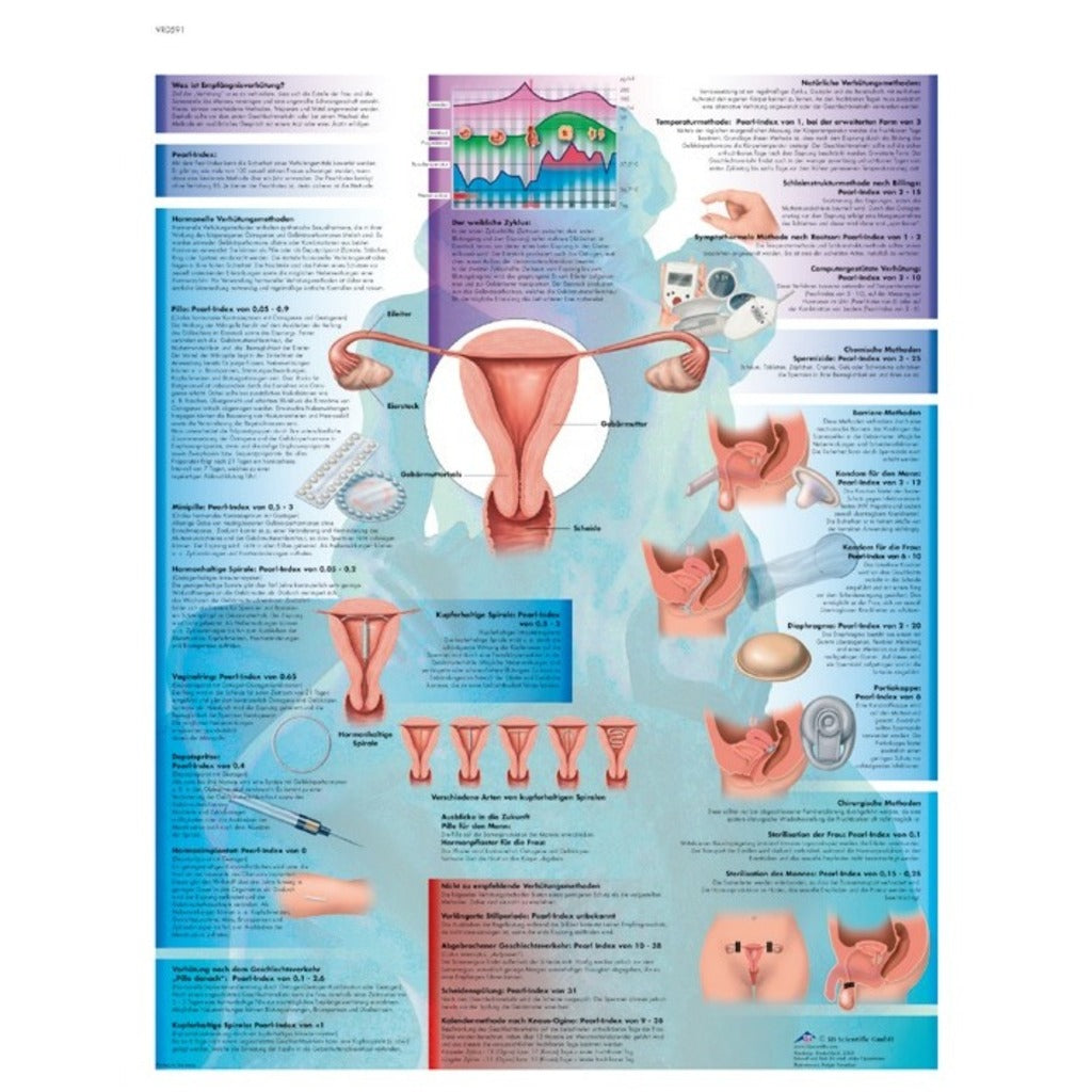 Planche anatomique - La contraception