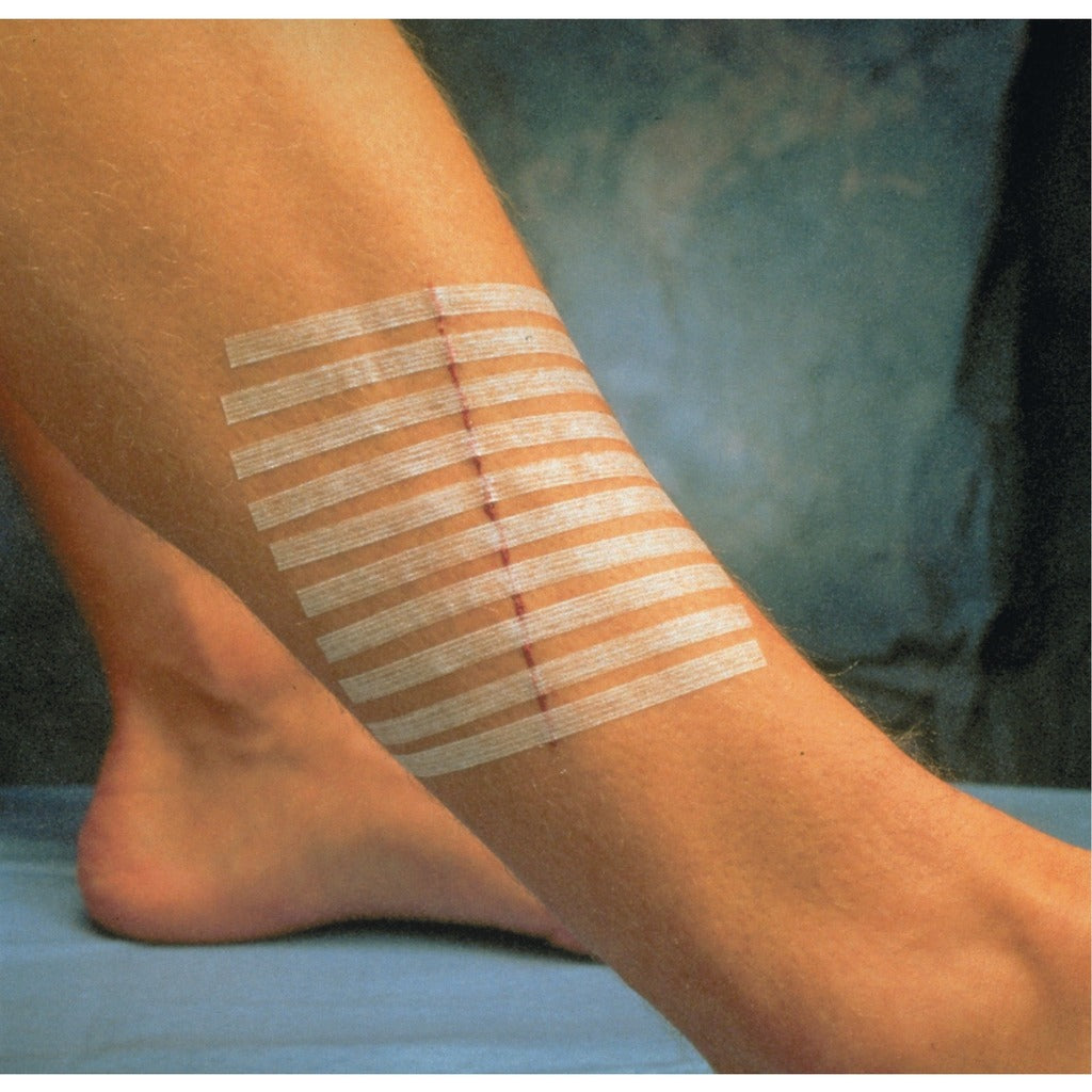 Sutures cutanées adhésives Steri-Strip