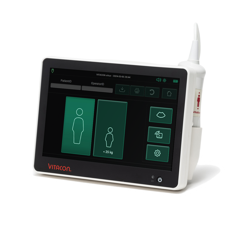 Bladder scanner VitaScan