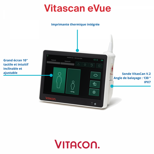 Bladder scanner VitaScan