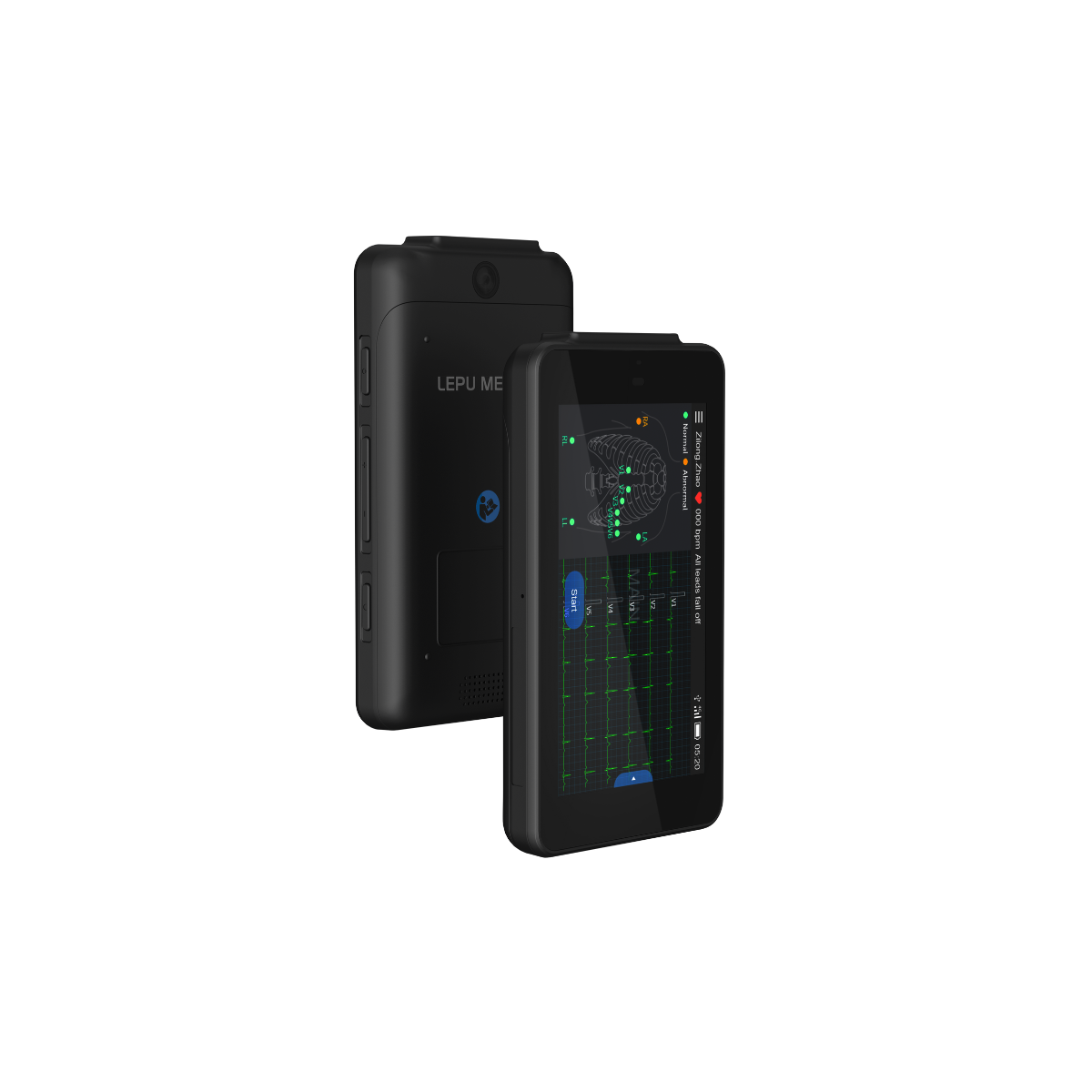 Tablette ECG de poche Cardio One Mini