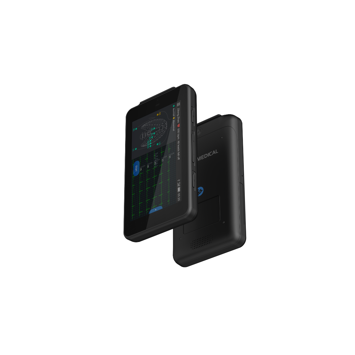 Tablette ECG de poche Cardio One Mini