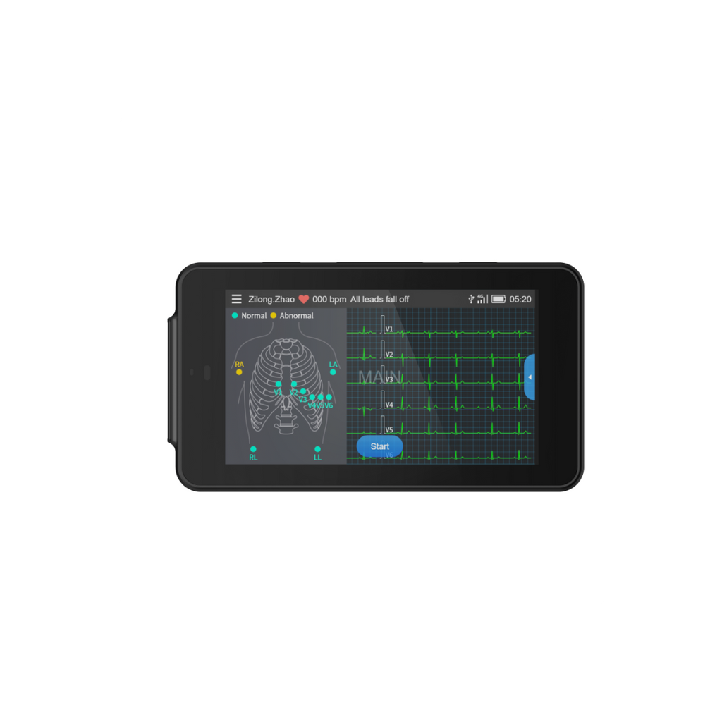 Tablette ECG de poche Cardio One Mini